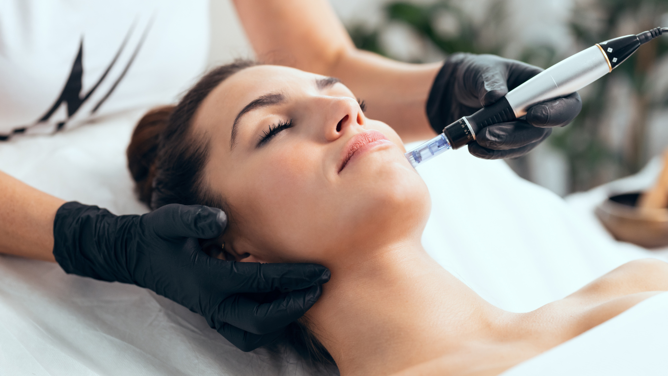 Microneedling Treatment